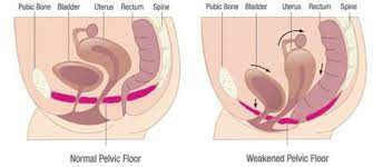 Understanding Female Pelvic Floor Muscles Anatomy - ProKegel